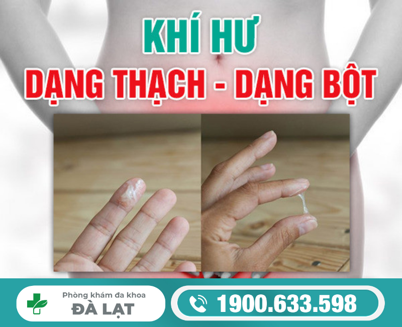 Hình ảnh minh họa